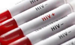 Biyologlar Derneği AIDS Günü dolayısıyla açıklama yaptı: Sürdürülebilir bir HIV politikası oluşturulması gerekiyor