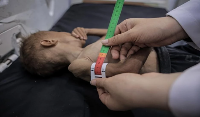 Gazze'de son 24 saatte 1'i çocuk 6 kişi daha açlıktan hayatını kaybetti